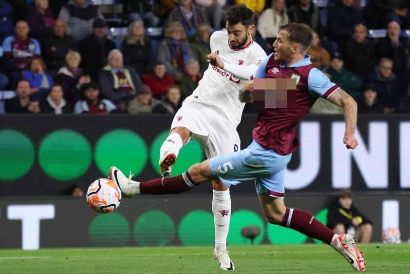 Nhận định bóng đá Man Utd vs Burnley, 21h00 ngày 30/08/2025